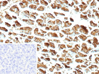 IHC staining of FFPE human pancreas tissue with recombinant CPA1 antibody (clone CPA1/9622R). Inset: PBS used in place of primary Ab (secondary Ab negative control). HIER: boil tissue sections in pH 9 10mM Tris with 1mM EDTA for 20 min and allow to cool before testing.