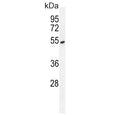 Western blot testing of human A549 cell lysate with Tyrosyl-DNA phosphodiesterase 2 antibody. Expected molecular weight: 41-51 kDa.
