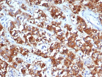 IHC staining of FFPE human adrenal gland tissue with IL18R1 antibody (clone IL18R1/7591). HIER: boil tissue sections in pH 9 10mM Tris with 1mM EDTA for 20 min and allow to cool before testing.