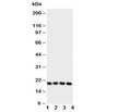 Western blot testing of LCN1 antibody and Lane 1: Jurkat; 2: COLO320; 3: SCG; 4: HeLa cell lysate