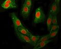 Immunofluorescent staining of FFPE human U-2 OS cells with RFC4 antibody (red) and Beta Tubulin mAb (green). HIER: steam section in pH6 citrate buffer for 20 min.