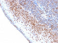 IHC testing of FFPE human tonsil with recombinant MCM7 antibody. Required HIER: boil tissue sections in pH 9 10mM Tris with 1mM EDTA for 10-20 min.