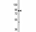 Western blot analysis of Dnmt3A antibody and Jurkat lysate. Predicted molecular weight: 100-130 kDa