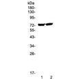 Western blot testing of human 1) 22RV1 and 2) PANC-1 cell lysate with EGR1 antibody at 0.5ug/ml. Predicted molecular weight: 57 kDa (monomer), ~110 kDa (cytoplasmic dimer), ~75 kDa (nuclear dimer).
