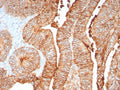IHC staining of FFPE human colon tissue with CDH17 antibody (clone CDH17/8158R). Inset: PBS used in place of primary Ab (secondary Ab negative control). HIER: boil tissue sections in pH 9 10mM Tris with 1mM EDTA for 20 min and allow to cool before testing.