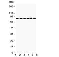 Western blot testing of IKKb antbody and Lane 1: rat heart; 2: (r) skeletal muscle; and human samples 3: PANC; 4: MCF-7; 5: HEPG2; 6: COLO320. Expected/observed size ~87KD