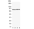 Western blot testing of CD168 antibody and Lane 1: MM231; 2: MM453; 3: HeLa; 4: A549 cell lysate. Expected molecular weight ~72 kDa (cell surface form) and 85-95 kDa (intracellular form).