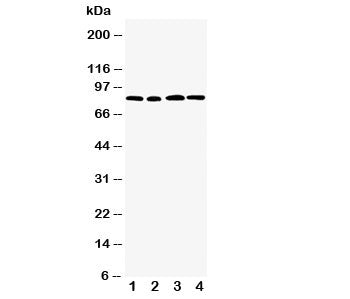 Western blot testing of CD168 antibody and Lane 1: MM231; 2: MM453; 3: HeLa; 4: A549 cell lysate. Expected molecular weight ~72 kDa (cell surface form) and 85-95 kDa (intracellular form).