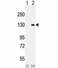 Western blot analysis of CSF1R antibody and 293 cell lysate (2 ug/lane) either nontransfected (Lane 1) or transiently transfected (2) with the CSF1R gene.