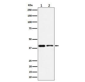 Western blot testing of 1) human Jurkat and 2) mouse RAW264.7 cell lysate with STOML2 antibody. Predicted molecular weight ~38 kDa.