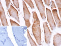 IHC staining of FFPE human skeletal muscle tissue with Cofilin 2 antibody (clone CFL2/9963). Inset: PBS used in place of primary Ab (secondary Ab negative control). HIER: boil tissue sections in pH 9 10mM Tris with 1mM EDTA for 20 min and allow to cool before testing.