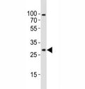 Western blot analysis of lysate from mouse brain tissue lysate using Olig1 antibody diluted at 1:1000. Predicted size 25~35 kDa