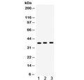 Western blot testing of 1) rat lung, 2) rat brain and 3) human PANC lysate with Surfactant protein D antibody. Predicted/observed molecular weight ~38 kDa.