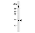 Western blot testing of human HeLa cell lysate with Tumor suppressor ARF antibody. Predicted molecular weight ~14 kDa.