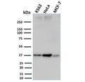 Western blot testing of human K562, HeLa and MCF-7 cell lysate with RAD51 antibody. Expected molecular weight ~37 kDa.
