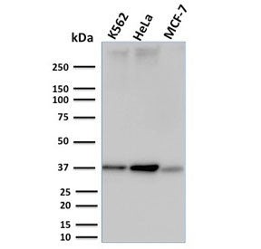 Western blot testing of human K562, HeLa and MCF-7 cell lysate with RAD51 antibody. Expected molecular weight ~37 kDa.
