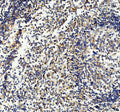 IHC staining of FFPE human tonsil tissue with CD33 antibody, HRP-secondary and DAB substrate. HIER: boil tissue sections in pH8 EDTA for 20 min and allow to cool before testing.