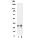 Western blot testing of FGF8 antibody and rat ovary tissue lysate. Predicted molecular weight: ~25 kDa.