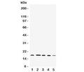Western blot testing of FAT10 antibody and Lane 1: HeLa; 2: SKOV; 3: MCF-7; 4: A549; 5: SMMC-7721 cell lysate. Expected/observed size: 18-22 kDa.