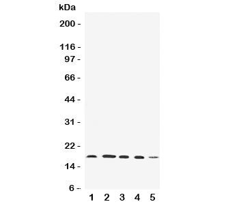 Western blot testing of FAT10 antibody and Lane 1: HeLa; 2: SKOV; 3: MCF-7; 4: A549; 5: SMMC-7721 cell lysate. Expected/observed size: 18-22 kDa.