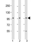 Western blot testing of human 1) HepG2, 2) PC-3 and 3) U-87 MG cell lysate with PCDH10 antibody at 1:2000. Predicted molecular weight: 113 kDa.