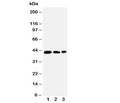 Western blot testing of AQP2 antibody and Lane 1: MCF-7; 2: SW620; 3: HT1080 cell lysate. The protein is routinely visualized from 29-46kDa depending on glycosylation level.