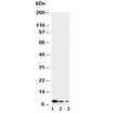 Western blot testing of CXCL4 antibody and Lane 1: recombinant human protein 10ng; 2: 5ng; 3: 2.5ng