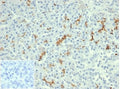 IHC staining of FFPE human pancreatic tissue with recombinant Cystic Fibrosis Transmembrane Regulator antibody (clone rCFTR/6476). Negative control inset: PBS used instead of primary antibody to control for secondary Ab binding. HIER: boil tissue sections in pH 9 10mM Tris with 1mM EDTA for 20 min and allow to cool before testing.