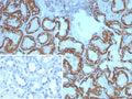 IHC staining of FFPE human kidney tissue with HSP60 antibody (clone HSPD1/8398R). Inset: PBS used in place of primary Ab (secondary Ab negative control). HIER: boil tissue sections in pH 9 10mM Tris with 1mM EDTA for 20 min and allow to cool before testing.