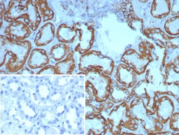 IHC staining of FFPE human kidney tissue with HSP60 antibody (clone HSPD1/8398R). Inset: PBS used in place of primary Ab (secondary Ab negative control). HIER: boil tissue sections in pH 9 10mM Tris with 1mM EDTA for 20 min and allow to cool before testing.