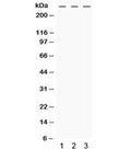 Western blot testing of human 1) HeLa, 2) MCF7 and 3) SW620 cell lysate with MGA antibody. Expected molecular weight ~331 kDa.