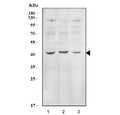 Western blot testing of human 1) HepG2, 2) 293T and 3) Raji cell lysate with EIF2B antibody. Expected molecular weight: ~38 kDa.