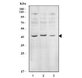 Western blot testing of human 1) HepG2, 2) 293T and 3) Raji cell lysate with EIF2B antibody. Expected molecular weight: ~38 kDa.