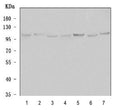 Western blot testing of 1) human SH-SY5Y, 2) human U-87 MG, 3) human MCF7, 4) human 293T, 5) rat brain, 6) rat C6 and 7) mouse brain tissue lysate with Alpha-Adaptin antibody. Predicted molecular weight ~108 kDa.
