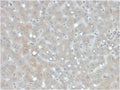 IHC staining of FFPE human liver with Apolipoprotein B antibody. HIER: boil tissue sections in pH 9 10mM Tris with 1mM EDTA for 20 min and allow to cool before testing.