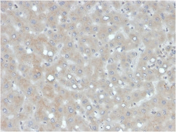 IHC staining of FFPE human liver with Apolipoprotein B antibody. HIER: boil tissue sections in pH 9 10mM Tris with 1mM EDTA for 20 min and allow to cool before testing.