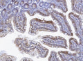 IHC staining of FFPE mouse lymph tissue with TOX antibody. HIER: boil tissue sections in pH8 EDTA for 20 min and allow to cool before testing.