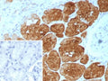IHC staining of FFPE human kidney tissue with recombinant Fatty Acid Binding Protein 1 antibody (clone FABP1/9085R). Inset: PBS used in place of primary Ab (secondary Ab negative control). HIER: boil tissue sections in pH 9 10mM Tris with 1mM EDTA for 20 min and allow to cool before testing.