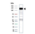 Western blot testing of human A431 cell lysate with recombinant Epidermal growth factor receptor antibody (clone EGFR/9166R). Expected molecular weight: 134-180 kDa depending on glycosylation level.