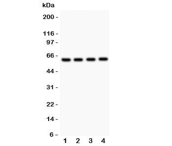 Western blot testing of SynCAM antibody and Lane 1: rat brain; 2: human HeLa; 3: (h) A549; 4: (h) Jurkat. Predicted molecular weight: ~48/37 kDa (isoforms 1/2) with N-linked and O-linked glycosylation each possibly adding ~25 kDa to the observed size.