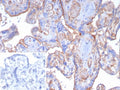 IHC staining of FFPE human placental tissue with CD141 antibody (clone THBD/8188R). Inset: PBS used in place of primary Ab (secondary Ab negative control). HIER: boil tissue sections in pH 9 10mM Tris with 1mM EDTA for 20 min and allow to cool before testing.