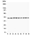 Western blot testing of PON1 antibody and Lane 1: rat liver; 2: (r) lung; 3: human placenta; 4: (r) testis; 5: (h) HeLa; 6: mouse HEPA; 7: (h) A549; 8: (h) Jurkat; 9: (h) SKOV lysate. Expected/observed molecular weight ~40 kDa.