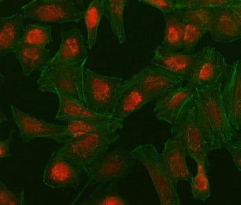 Immunofluorescent staining of FFPE human A549 cells with Interferon regulatory factor 5 antibody (red) and Phalloidin-AF488 (green). HIER: steam section in pH6 citrate buffer for 20 min.