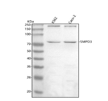 Western blot analysis of SMPD3 using anti-SMPD3 antibody. Lane 1: human K562 whole cell lysates, Lane 2: human Caco-2 whole cell lysates. After electrophoresis, proteins were transferred to a nitrocellulose membrane at 150 mA for 50-90 min. Blocked the membrane with 5% non-fat milk/TBS for 1.5 hour at RT.