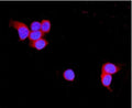 Immunofluorescent staining of FFPE human MCF7 cells with TNXB antibody (red) and DAPI nuclear stain (blue). HIER: steam section in pH6 citrate buffer for 20 min.