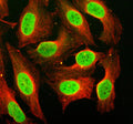 Immunofluorescent staining of CBX6 using anti-CBX6 antibody (green) and anti-Beta Tubulin antibody (red). CBX6 was detected in an immunocytochemical section of U2OS cells. Enzyme antigen retrieval was performed using IHC enzyme antigen retrieval reagent for 15 mins. The cells were blocked with 10% goat serum. And then incubated with 5 ug/ml rabbit anti-CBX6 antibody and mouse anti-Beta Tubulin antibody overnight at 4oC.