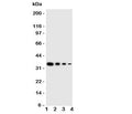 Western blot testing of LAT2 antbody; Lane 1: Recombinant human protein 10ng; 2: 5ng; 3: 2.5ng; 4: 1.25ng