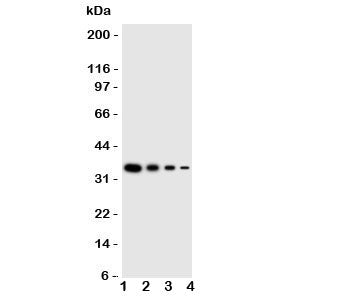 Western blot testing of LAT2 antbody; Lane 1: Recombinant human protein 10ng; 2: 5ng; 3: 2.5ng; 4: 1.25ng