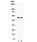 Western blot testing of 1) rat liver and 2) mouse liver lysate with CYP1A2 antibody. Predicted/observed molecular weight: ~58 kDa.