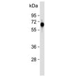 Western blot testing of human placental tissue with FPGS antibody. Predicted molecular weight ~65 kDa.